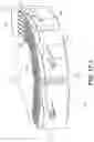 Fig. 38 - Coiling implantable prostheses and methods for implanting