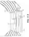 Fig. 40 - Coiling implantable prostheses and methods for implanting