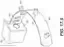 Fig. 42 - Coiling implantable prostheses and methods for implanting