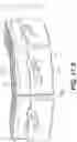 Fig. 45 - Coiling implantable prostheses and methods for implanting