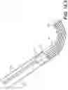 Fig. 52 - Coiling implantable prostheses and methods for implanting
