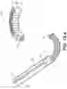 Fig. 53 - Coiling implantable prostheses and methods for implanting