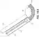 Fig. 55 - Coiling implantable prostheses and methods for implanting
