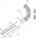 Fig. 56 - Coiling implantable prostheses and methods for implanting