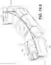 Fig. 61 - Coiling implantable prostheses and methods for implanting
