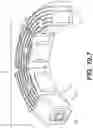 Fig. 63 - Coiling implantable prostheses and methods for implanting