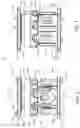 Fig. 03 - Expandable vertebral body replacement device and method