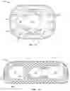 Fig. 09 - VERTEBRAL BODY REPLACEMENT