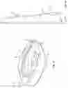 Fig. 10 - VERTEBRAL BODY REPLACEMENT