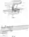 Fig. 13 - VERTEBRAL BODY REPLACEMENT