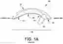 Fig. 02 - TALAR IMPLANT