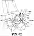 Fig. 09 - TALAR IMPLANT