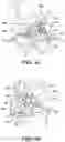 Fig. 12 - TALAR IMPLANT