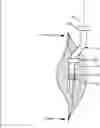 Fig. 01 - PROSTHETIC COMPONENT EXTRACTOR