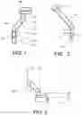 Fig. 02 - PROSTHETIC COMPONENT EXTRACTOR