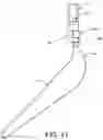 Fig. 11 - PROSTHETIC COMPONENT EXTRACTOR