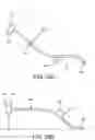 Fig. 27 - PROSTHETIC COMPONENT EXTRACTOR