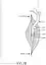 Fig. 28 - PROSTHETIC COMPONENT EXTRACTOR