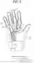 Fig. 05 - Finger motion assist apparatus
