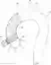 Fig. 01 - Landing zone for endovascular procedures