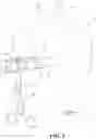 Fig. 04 - Landing zone for endovascular procedures