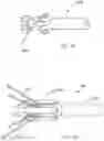 Fig. 10 - STENT GRAFT WITH A LONGITUDINAL SUPPORT MEMBER
