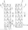 Fig. 26 - STENT GRAFT WITH A LONGITUDINAL SUPPORT MEMBER
