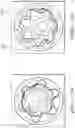 Fig. 29 - STENT GRAFT WITH A LONGITUDINAL SUPPORT MEMBER