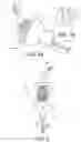 Fig. 07 - Loading systems for collapsible prosthetic heart valve devices and methods thereof