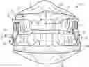 Fig. 01 - Oral appliance device
