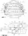 Fig. 02 - Oral appliance device