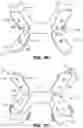 Fig. 03 - Oral appliance device