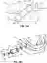 Fig. 04 - Oral appliance device