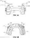 Fig. 05 - Oral appliance device