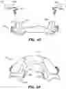 Fig. 06 - Oral appliance device
