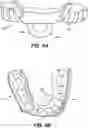 Fig. 08 - Oral appliance device