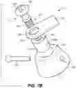 Fig. 10 - Oral appliance device