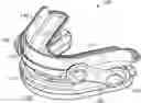 Fig. 01 - Thermoplastic dental appliance system and method