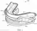Fig. 02 - Thermoplastic dental appliance system and method