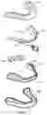 Fig. 04 - Thermoplastic dental appliance system and method