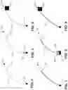 Fig. 05 - SYSTEMS AND METHODS FOR OBSTRUCTIVE SLEEP APNEA DETECTION AND MONITORING