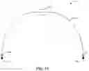 Fig. 07 - SYSTEMS AND METHODS FOR OBSTRUCTIVE SLEEP APNEA DETECTION AND MONITORING