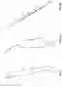 Fig. 03 - OPHTHALMOLOGICAL SURGERY MICROSURGERY INSTRUMENTS AND METHODS OF USE IN PARS PLANA VITRECTOMY FOR INCREASING SURGICAL PRECISION AND REDUCING VITREORETINAL INSTRUMENT INSERTIONS AND REMOVALS AND RELATED TRAUMA