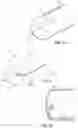Fig. 08 - OPHTHALMOLOGICAL SURGERY MICROSURGERY INSTRUMENTS AND METHODS OF USE IN PARS PLANA VITRECTOMY FOR INCREASING SURGICAL PRECISION AND REDUCING VITREORETINAL INSTRUMENT INSERTIONS AND REMOVALS AND RELATED TRAUMA