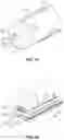 Fig. 11 - OPHTHALMOLOGICAL SURGERY MICROSURGERY INSTRUMENTS AND METHODS OF USE IN PARS PLANA VITRECTOMY FOR INCREASING SURGICAL PRECISION AND REDUCING VITREORETINAL INSTRUMENT INSERTIONS AND REMOVALS AND RELATED TRAUMA