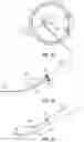 Fig. 13 - OPHTHALMOLOGICAL SURGERY MICROSURGERY INSTRUMENTS AND METHODS OF USE IN PARS PLANA VITRECTOMY FOR INCREASING SURGICAL PRECISION AND REDUCING VITREORETINAL INSTRUMENT INSERTIONS AND REMOVALS AND RELATED TRAUMA