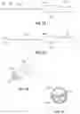 Fig. 16 - OPHTHALMOLOGICAL SURGERY MICROSURGERY INSTRUMENTS AND METHODS OF USE IN PARS PLANA VITRECTOMY FOR INCREASING SURGICAL PRECISION AND REDUCING VITREORETINAL INSTRUMENT INSERTIONS AND REMOVALS AND RELATED TRAUMA