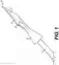 Fig. 02 - EYE SURGERY METHOD USING SURGICAL CANNULATED INSTRUMENT