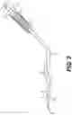 Fig. 03 - EYE SURGERY METHOD USING SURGICAL CANNULATED INSTRUMENT