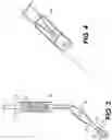 Fig. 04 - EYE SURGERY METHOD USING SURGICAL CANNULATED INSTRUMENT